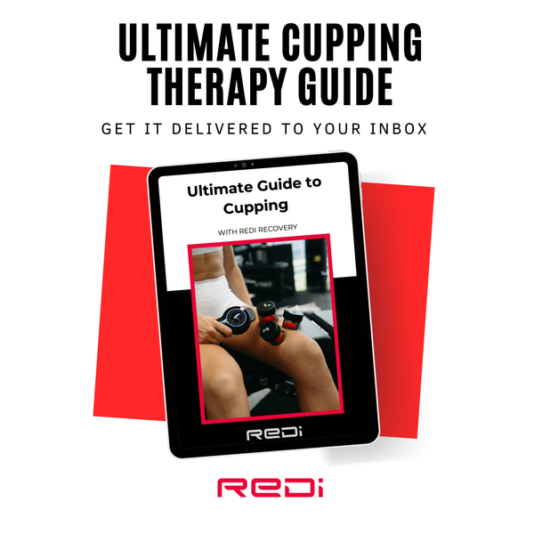 Ultimate Cupping Therapy Guide