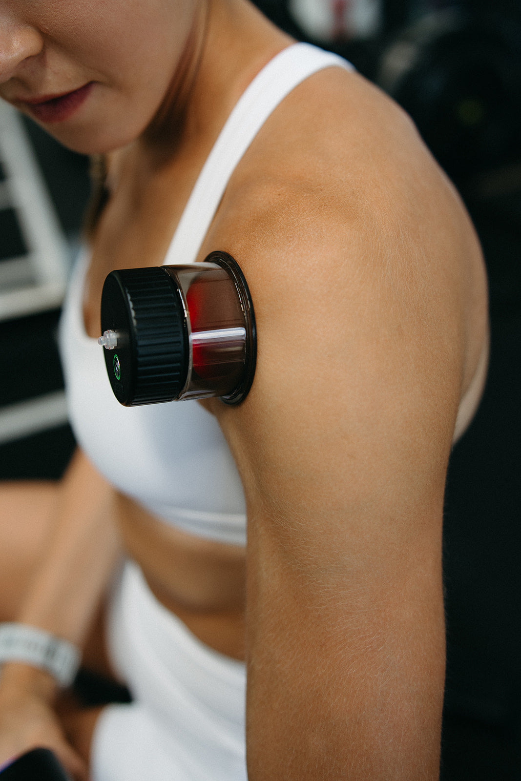 REDi MyoFlux Cupping